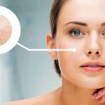 Cấp Ẩm Và Cấp Nước Cho Da-moi-nhat