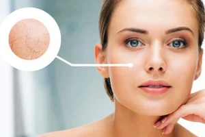 Cấp Ẩm Và Cấp Nước Cho Da-moi-nhat